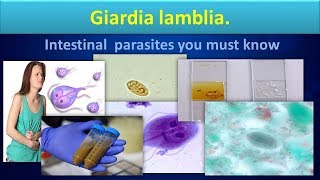 Giardia lambliaLife cycleStructureLabdiagnosisGiardiasisClear overview [upl. by Aihseyk]