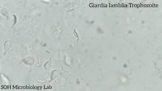 Giardia lamblia Trophozoite in stool [upl. by Leavitt]